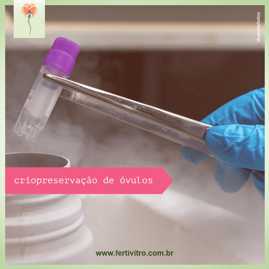 Criopreservação de óvulos: possibilitando gestações tardias