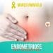 Março Amarelo: Conscientização da Endometriose
