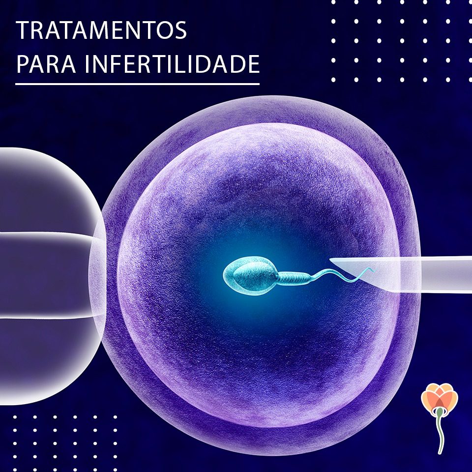 Principais tratamentos para infertilidade