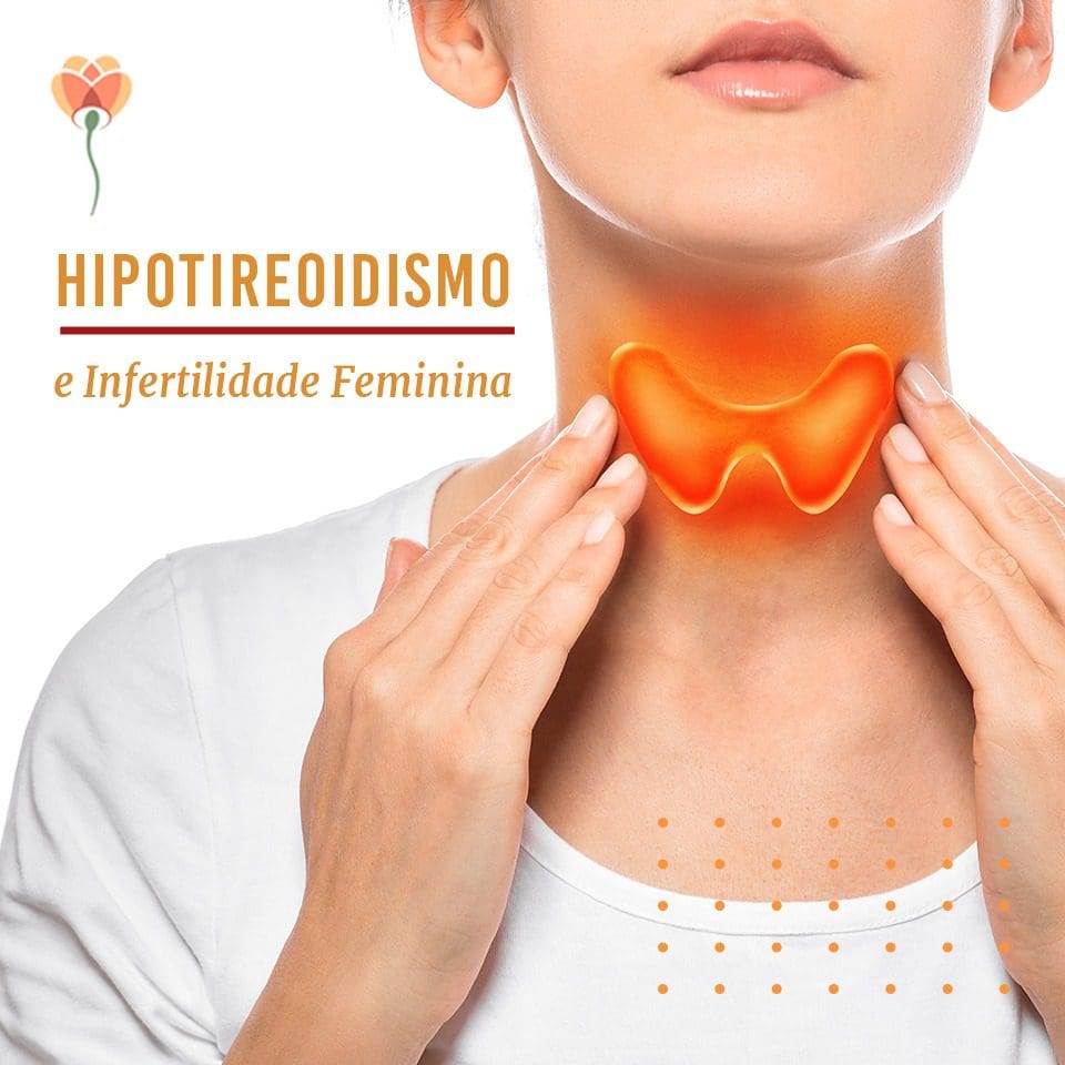 Hipotireoidismo e Infertilidade