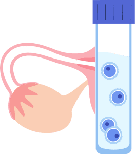 fertilização in vitro etapa 2 aspiração folicular injeção intracitoplasmática de espermatozoide icsi